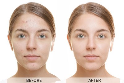 Before and After