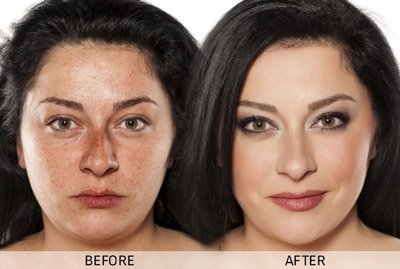 Before-After-5-f